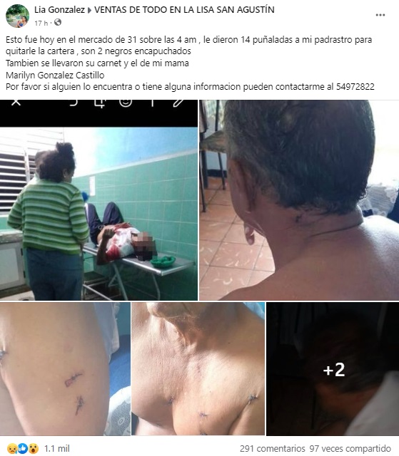 Cubano recibe 14 puñaladas durante un asalto en La Habana