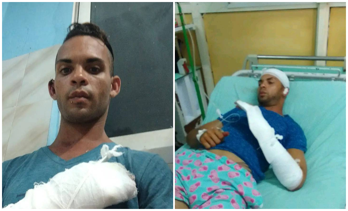 Joven fue atacado con un machete durante un robo en La Habana