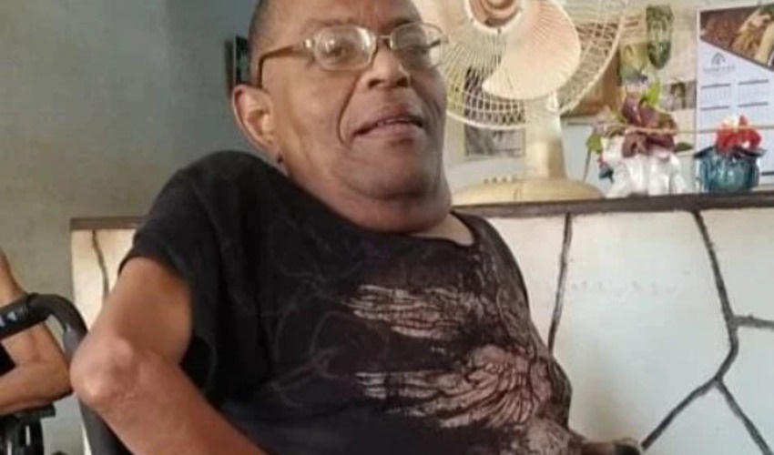 El cubano contrajo polio cuando nació, y desde entonces ha tenido problemas para moverse. (Foto © gogetfunding.com)