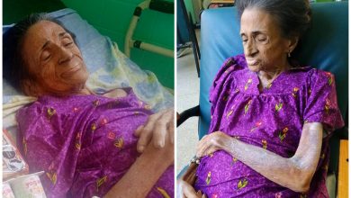 Sonia Benítez, anciana fallecida en Cuba por negligencia. (Foto © Pichichi Paws RESCUE- X)