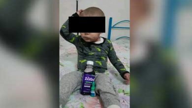 Menor necesita ayuda para tratar su rara enfermedad de la piel. (Foto © ElMusk Reeve-Facebook)