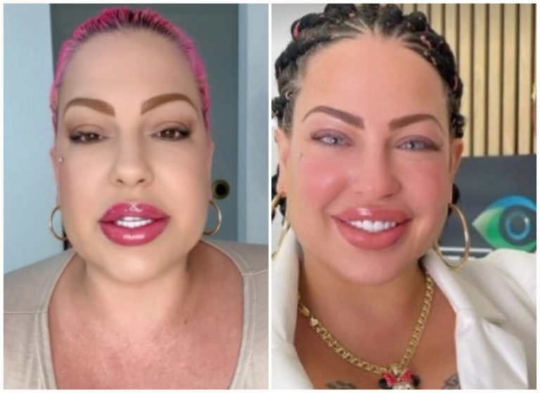 ¡Increíble cambio! La Diosa se somete a cirugía para cambiar su color de ojos