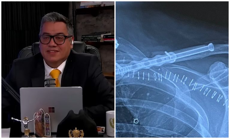 Manuel Milanés habla sobre su cirugía: tiene un tornillo de titanio en el hombro