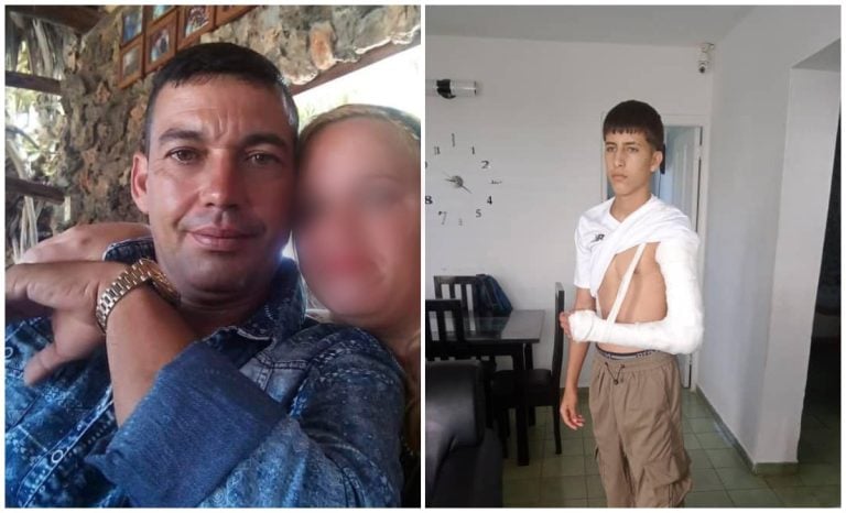 Policía es denunciado por fracturarle el brazo de un menor en Holguín
