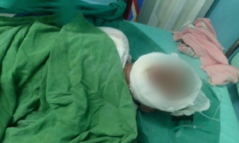 La Habana: piden ayuda para dos niños en estado crítico tras explosión de gas