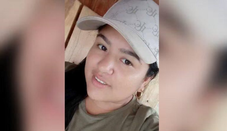 Joven fallece por graves quemaduras en Santiago de Cuba: acusan a su esposo