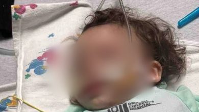 El bebé necesita tratamiento en un hospital especializado de Florida. (Foto © GoFundMe)