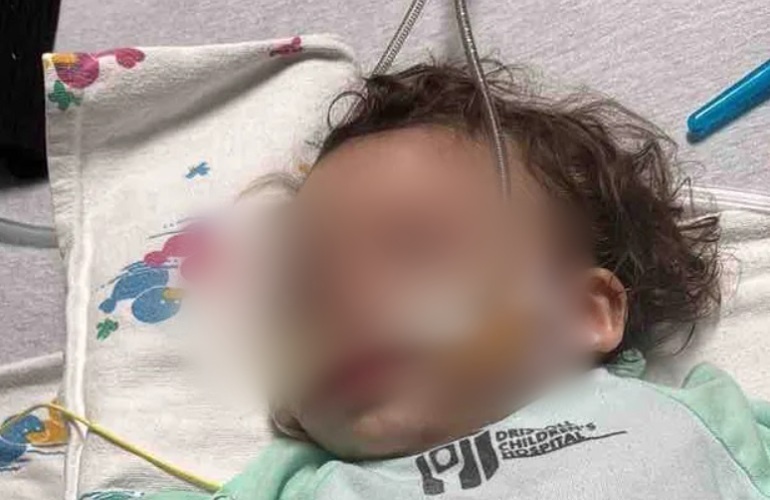 El bebé necesita tratamiento en un hospital especializado de Florida. (Foto © GoFundMe)