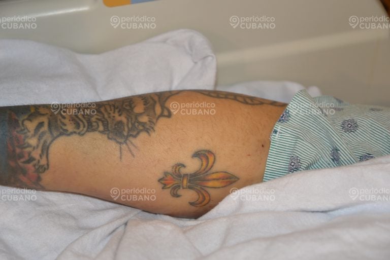 El Taiger estuvo diez días hospitalizado tras recibir un disparo en la cabeza. (Foto © Periódico Cubano)