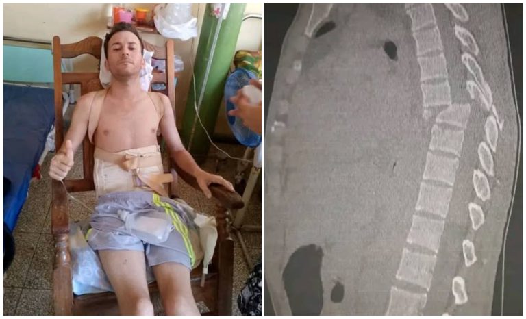 Piden ayuda para joven cubano que quedó paralizado tras caer de un tercer piso