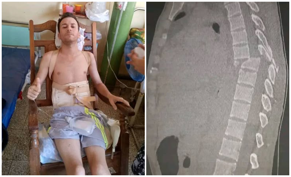 El joven quedó paralizado tras una grave caída. (Foto © Amanda Quevedo Rosabal-Facebook)