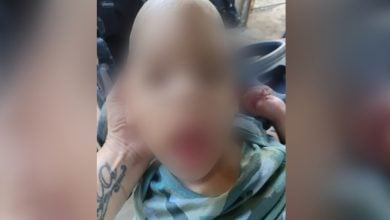 El menor requiere de alimentos y medicamentos. (Foto © Minerva Sifonte-Facebook)