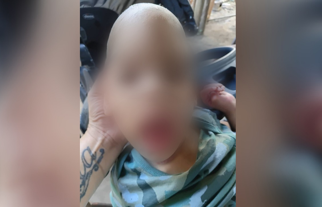 El menor requiere de alimentos y medicamentos. (Foto © Minerva Sifonte-Facebook)