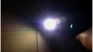 Los médicos admitieron que tienen que usar las linternas de sus teléfonos para ver en el quirófano. (Foto © Asere Noticias)